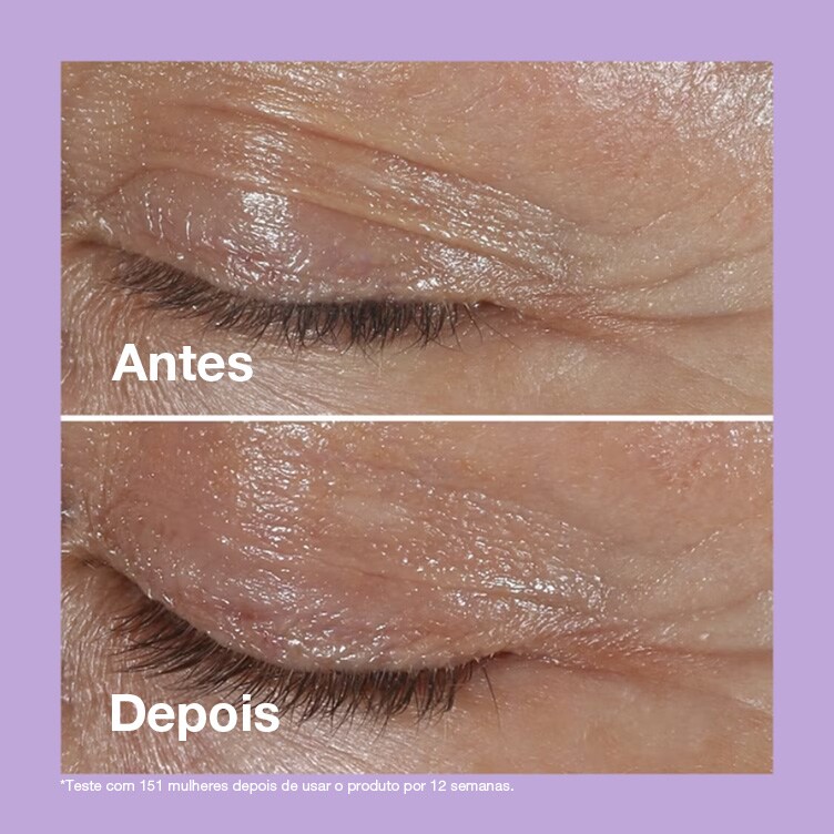 Antes Depois de 12 semanas
